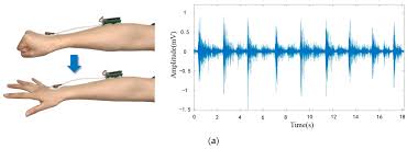 A surface EMG device reading muscle signals from the skin
